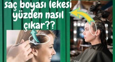 Saç Boyası LEKESİ Yüzden, Elden NASIL ÇIKAR | TAŞAN SAÇ BOYASI Çıkarmanın EN KOLAY YOLU NEDİR ?