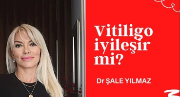 VİTİLİGO NEDEN OLUR? (VİTİLİGO NASIL GEÇER?) Dr ŞALE YILMAZ
