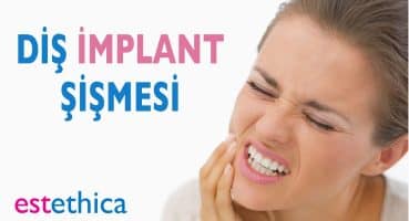 Diş İmplant Şişmesi Neden Olur? | Dr. estethica