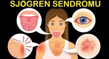 Sjögren Sendromu: En Etkili Protokol Nedir? | Dr.Berg Türkçe