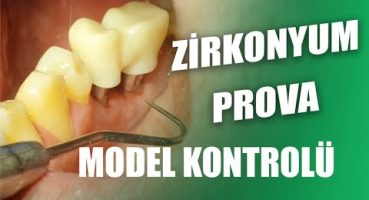 Zirkonyum Provası Nasıl Yapılır? İmplant Üstü Zirkonyum Alçı Model ile Hasta Ağzı Kıyaslaması