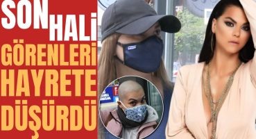 Kafasını Kazıtan Nez’in Son Halini Görenler Gözlerine İnanamadı | ‘ZOR GELİYOR’ İTİRAFI Magazin Haberi