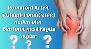 Romatoid Artrit (iltihaplı romatizma) neden olur Bentonit nasıl fayda sağlar