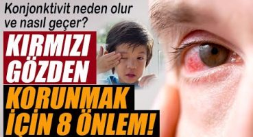 Göz kanlanmasından korunmak için 8 önlem! Konjonktivit neden olur ve nasıl geçer?