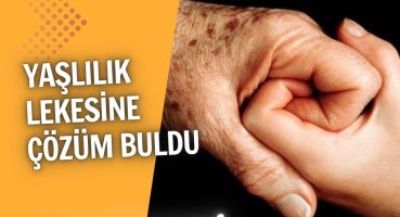 KAŞINTI NEDEN OLUR? DALAK VE KİRPİ YEMEK HANGİ HASTALIĞA İYİ GELİR? OYTUN ERBAŞ-ALİ TARAKCI