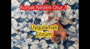 BEBEKLERDE KONAK NEDEN OLUR ? KONAK TEDAVİSİ NASIL YAPILIR ? Uygulamalı gösterim