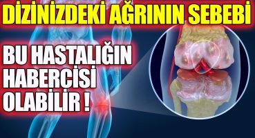 Menisküs Yırtığı Nedir ? Belirtileri Nelerdir ? Menisküs Yırtılması Neden Olur ve Nasıl Anlaşılır ?