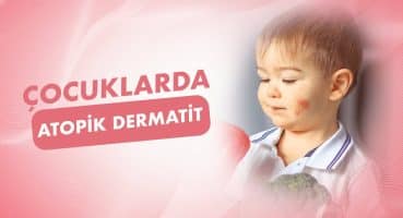 Çocuklarda Atopik Dermatit Neden Olur?