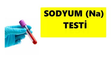 SODYUM YÜKSEKLİĞİ VE DÜŞÜKLÜĞÜ NEDEN OLUR?