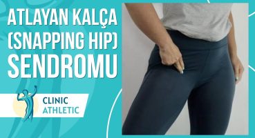 Atlayan Kalça Sendromu Nedir? Snapping Hip Neden Olur?