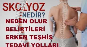 Skolyoz Nedir Neden Olur Çocuklar’da Belirtileri Nelerdir Erken Teşhis ve Tedavisi Nasıl Yapılır ?