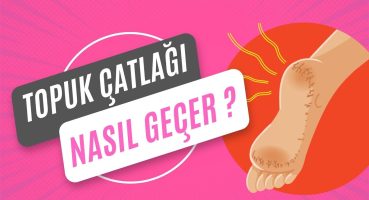 Topuk Çatlağı Neden Olur? Nasıl Geçer?